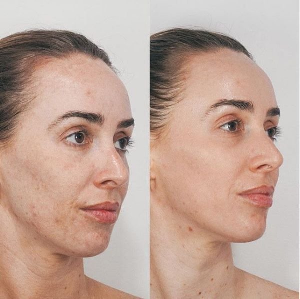 9a0611eaceb113ed6566865411f1cecd