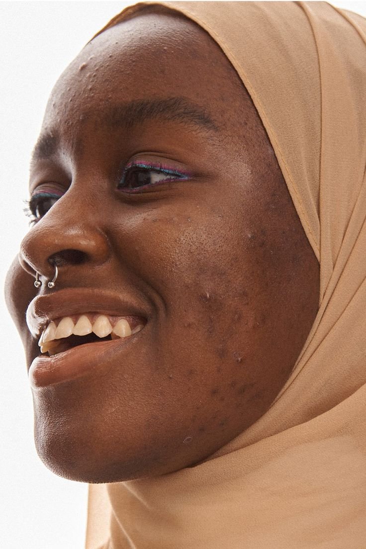 clear skin does not define